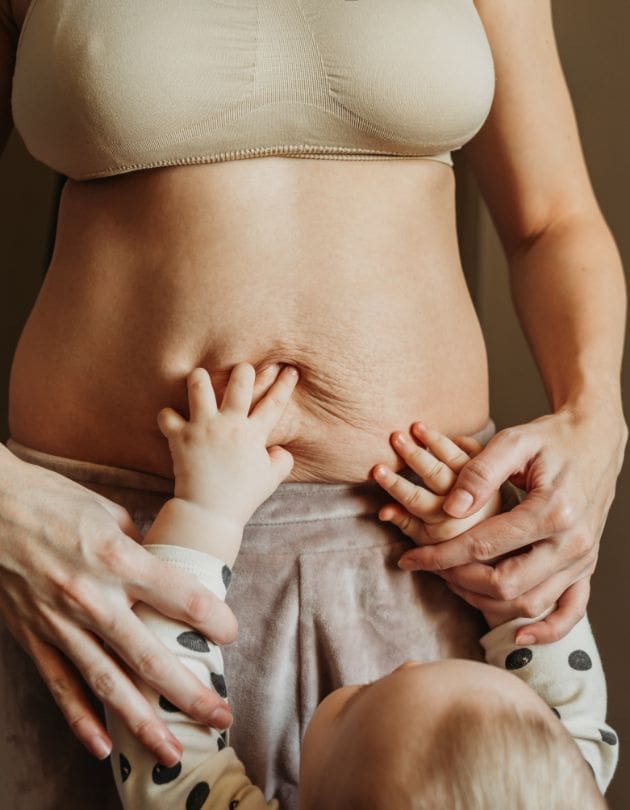 HR Plastic Sugery - Mummy Rejuvenation Common Causes